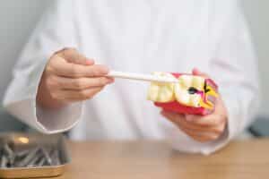 A dentist holds a tooth anatomy model to explain deep tooth decay, tartar buildup, and the importance of oral health during dental awareness events